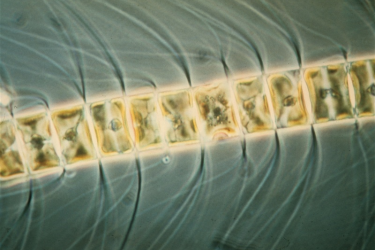Microscopic view of a marine phytoplankton species (Chaetoceros sp.)