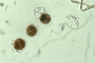 Microscope image of algae 