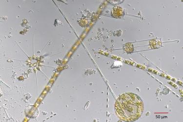 Microscopic images of plankton, some are tube shaped with others are circular or star shaped.