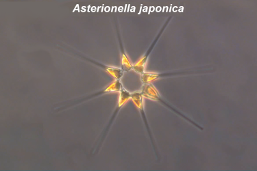 Microscopic view of phytoplankton Asterionella japonica, star-shaped with long "arms"