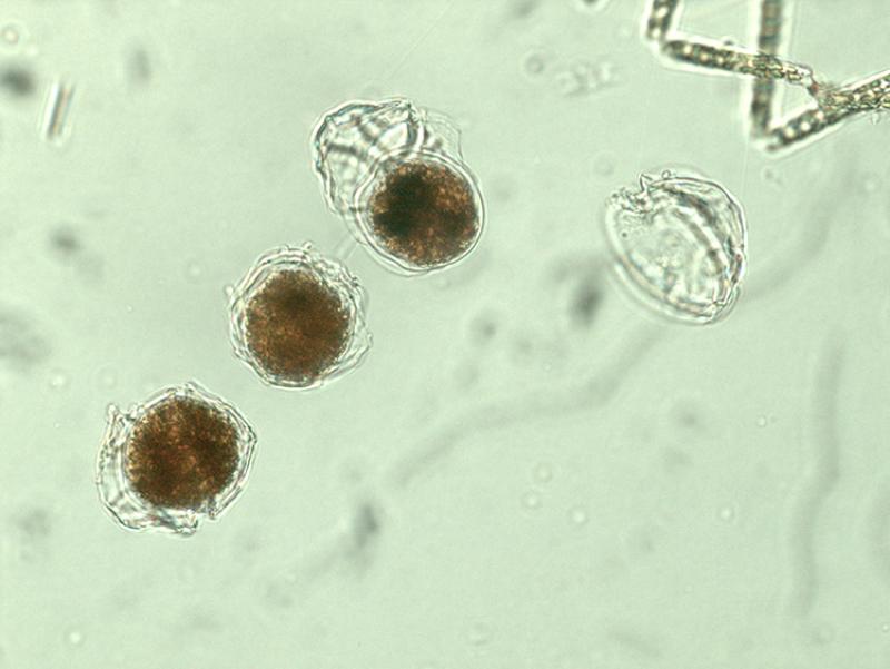 Microscope image of algae 