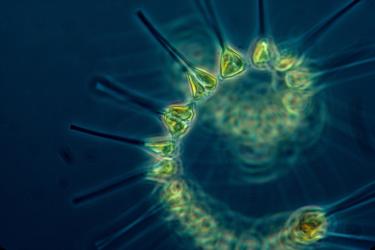 Microscopic view of green chain forming diaton against a blue background.