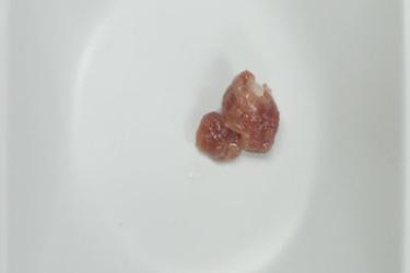 A sample of whale tissue collected for forensic analysis