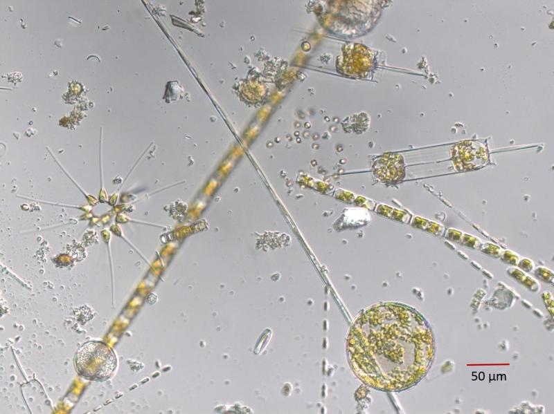 Microscopic images of plankton, some are tube shaped with others are circular or star shaped.