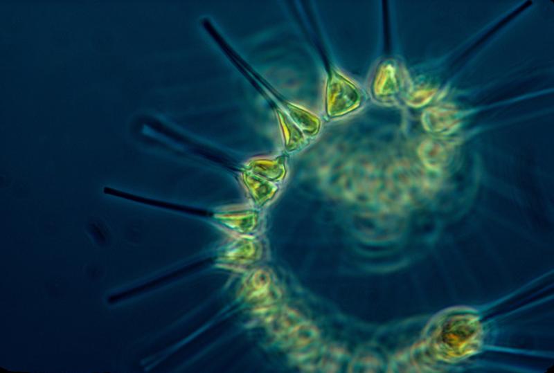 Microscopic view of green chain forming diaton against a blue background.